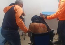 Así quedó motorizado tras deslizar la moto en Dabajuro