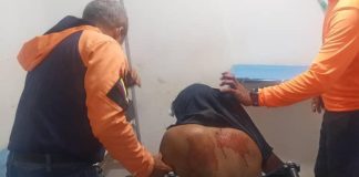 Así quedó motorizado tras deslizar la moto en Dabajuro