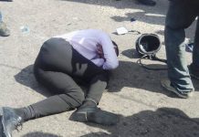 Funcionario del Cicpc sufre traumatismo craneoencefálico durante colisión