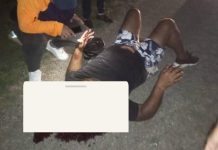 Lesionado motorizado durante colisión en Tocuyo de La Costa