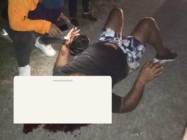 Lesionado motorizado durante colisión en Tocuyo de La Costa