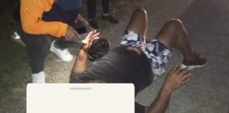 Lesionado motorizado durante colisión en Tocuyo de La Costa