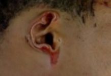 Le cortaron una oreja a un ladrón