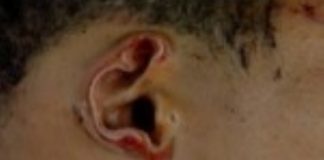 Le cortaron una oreja a un ladrón