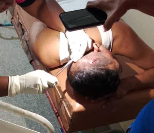 Motorizado sufrió lesiones en la cabeza en Jadacaquiva