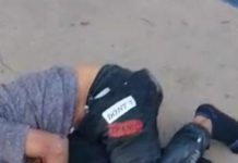 Muere motorizado que sufrió un traumatismo craneoencefálico severo en Coro