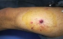 Criador sufrió herida de proyectil de arma de fuego en Democracia