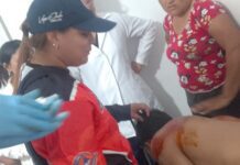 Esto le ocurrió a un joven que se cayó de una moto en Capatárida