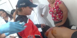 Esto le ocurrió a un joven que se cayó de una moto en Capatárida