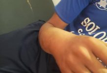 Fue a golpear un cheveve y lo mordió un cascabel en Bariro