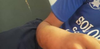 Fue a golpear un cheveve y lo mordió un cascabel en Bariro