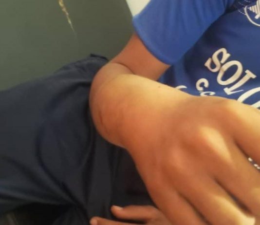 Fue a golpear un cheveve y lo mordió un cascabel en Bariro