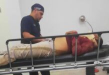 Motorizado ebrio deslizó en la perimetral de Los Taques