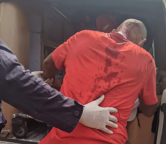 Sexagenario y veinteañero lesionados durante colisión en Dabajuro