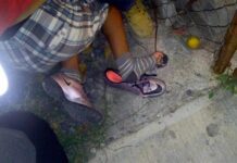 Adolescente cayó encima de una cabilla en Coro