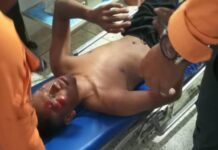 Así quedó un PNB que deslizó en moto en Río Seco