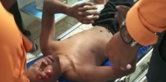 Así quedó un PNB que deslizó en moto en Río Seco