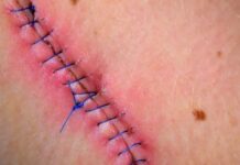 Le cortaron el cuello con una navaja