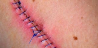 Le cortaron el cuello con una navaja