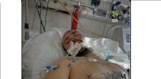 Grave venezolano que fue arrollado en Argentina