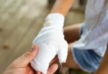 Le quemó la mano a la hija por agarrarle el celular