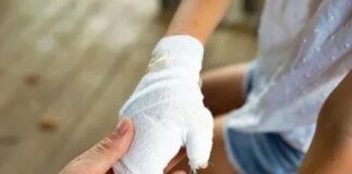 Le quemó la mano a la hija por agarrarle el celular