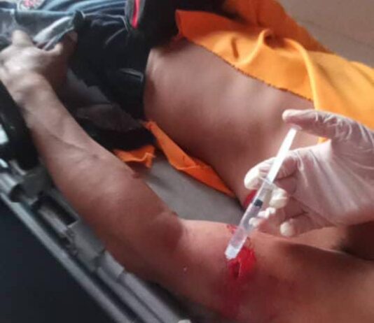 Motorizado deslizó en El Elevado de La Vela