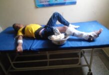 Lesionado adolescente al deslizar la moto en Las Carmelitas