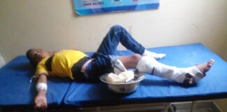 Lesionado adolescente al deslizar la moto en Las Carmelitas