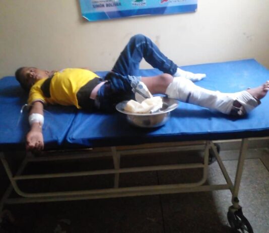 Lesionado adolescente al deslizar la moto en Las Carmelitas