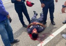 PNB sufre traumatismo craneoencefálico durante accidente en Punto Fijo