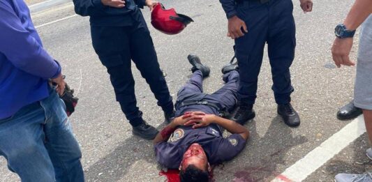 PNB sufre traumatismo craneoencefálico durante accidente en Punto Fijo