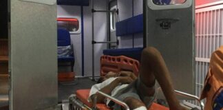 Adolescente sufrió fractura en deslizamiento de moto