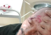 Dos lesionados en la avenida Bolívar de Pueblo Nuevo en colisión de moto y carro