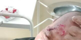 Dos lesionados en la avenida Bolívar de Pueblo Nuevo en colisión de moto y carro