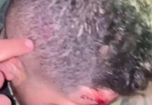 Le «partieron» la cabeza con una cacha de pistola en La Cañada