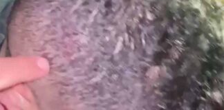 Le «partieron» la cabeza con una cacha de pistola en La Cañada