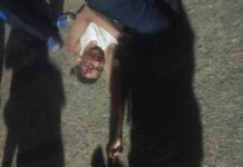 Conducían moto bajo los efectos del alcohol y esto les pasó