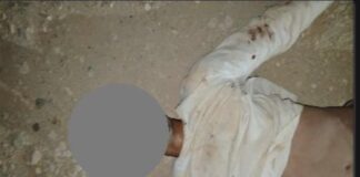 Joven falleció tras sufrir una golpiza en Punta Cardón