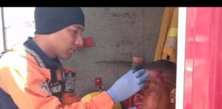 Hombre en situación de calle sufrió un botellazo en la frente en Puerta Maraven