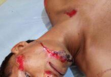 Fotos| Arrollado hombre por una gandola en Santa Rita del municipio Falcón