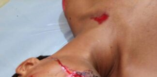 Fotos| Arrollado hombre por una gandola en Santa Rita del municipio Falcón