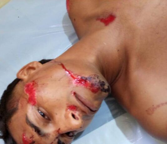 Fotos| Arrollado hombre por una gandola en Santa Rita del municipio Falcón
