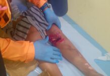 Lesionada mujer tras impactar la moto que conducía con un chivo