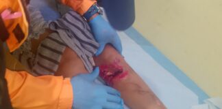 Lesionada mujer tras impactar la moto que conducía con un chivo