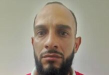 Mordió a su expareja en el rostro