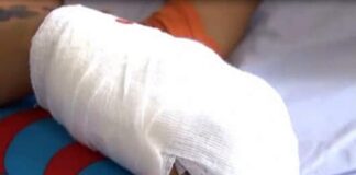 Trabajador recibió descarga eléctrica en Punto Fijo cuando colocaban un poste