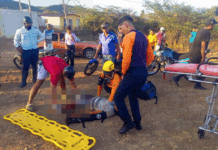 Funcionario de la PNB Falcón sufre amputación de pierna en choque