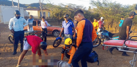 Funcionario de la PNB Falcón sufre amputación de pierna en choque