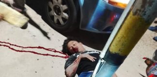 Accidente dejó dos lesionados en Punto Fijo